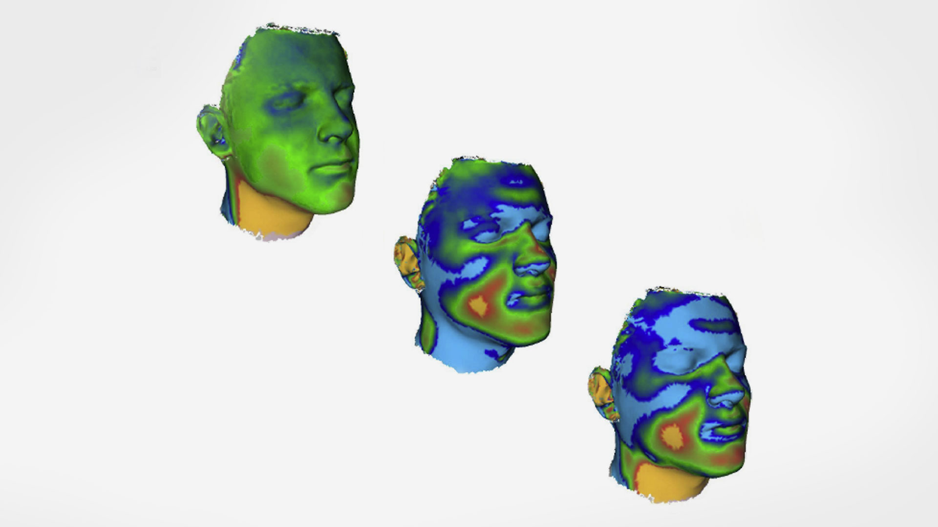 Artec Eva for precisely measuring shifts in facial soft tissues | Artec ...