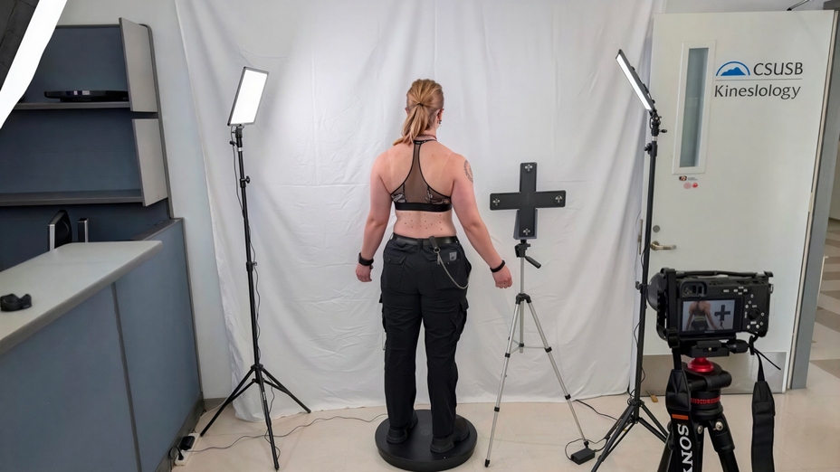 3D-printed prosthetics
