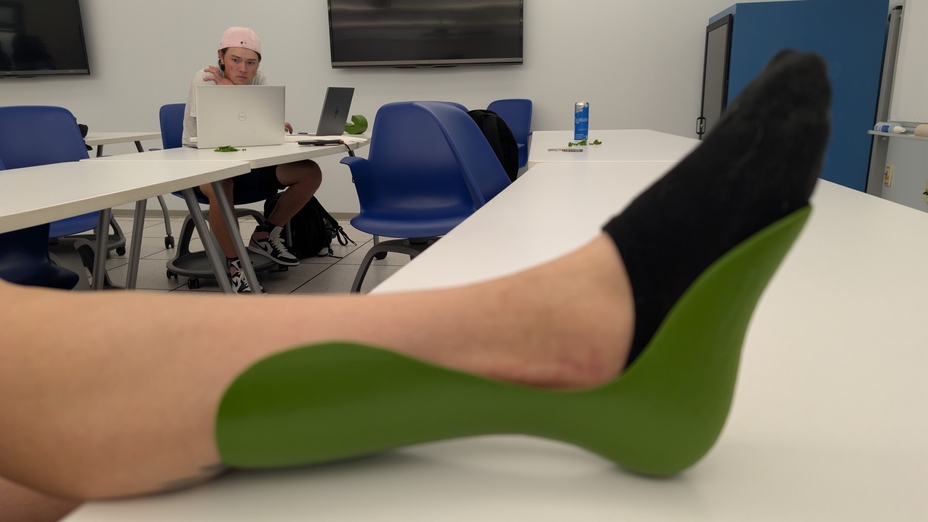 3D-printed prosthetics