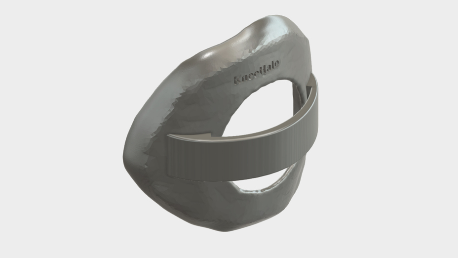 3D-printed prosthetics